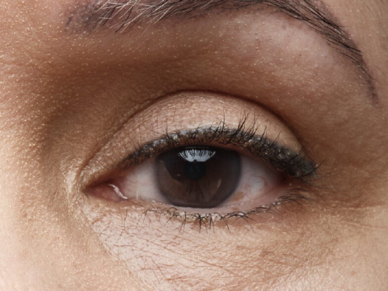 Close up of a female patient's eye